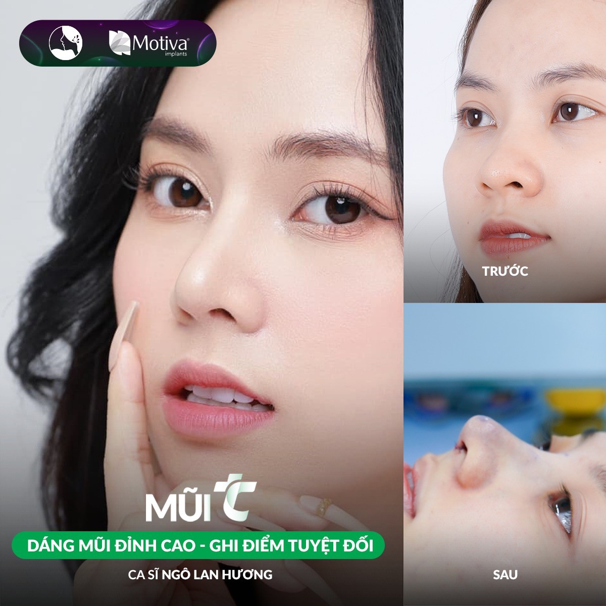 TOP 11 bệnh viện thẩm mỹ Hà Nội bác sĩ tay nghề giỏi nhất